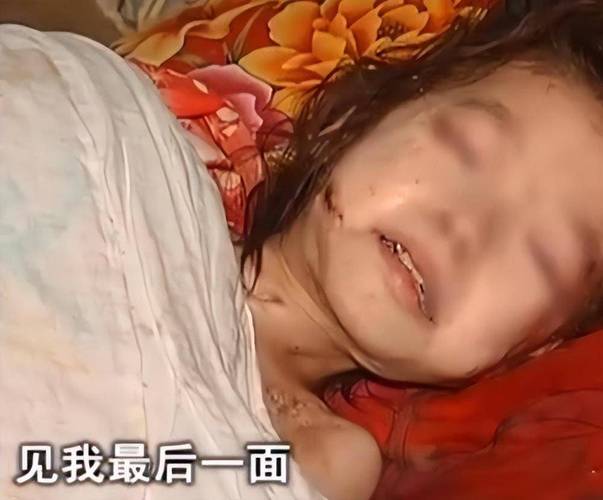 四川小女孩玉玲生命的救赎最终结果 四川小玉玲病好的视频